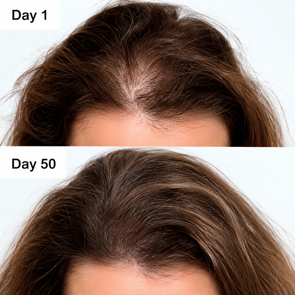 Scalp Hair Growth Serum