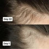 Scalp Hair Growth Serum